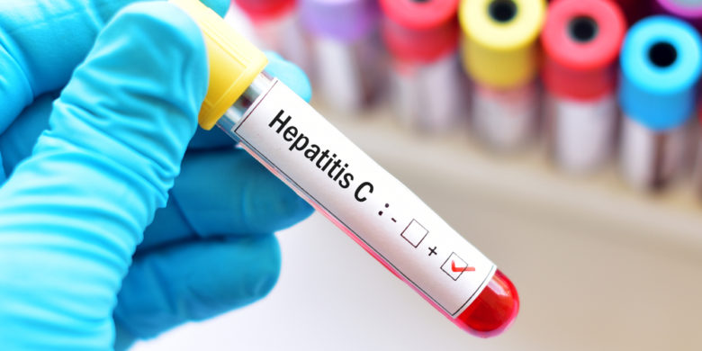 The best kind of burial or final expense insurance for Hepatitis