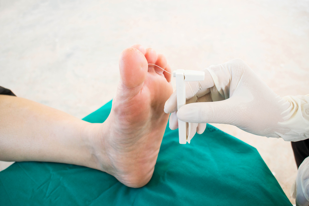 Diabetic Neuropathy and Burial Insurance