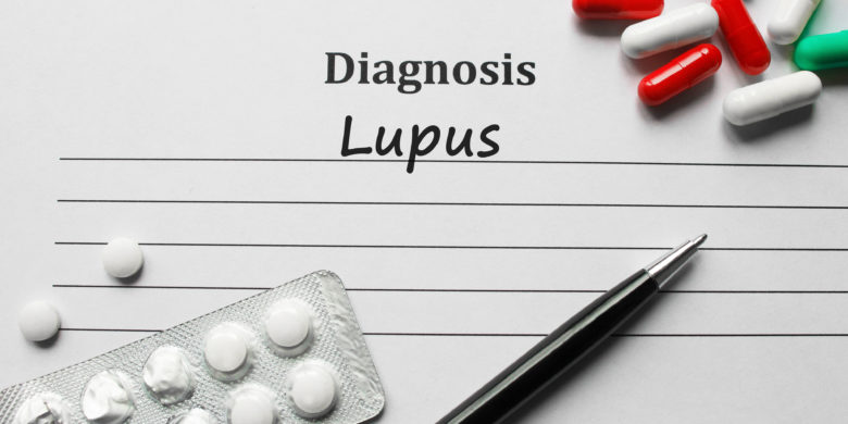 Burial Insurance with Lupus